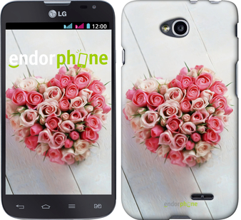 Чехлы для LG L70 Dual D325, - печать на силиконовых чехлах для ЛГ Л70 дуал Д325 Чехлы для LG L70 Dual D325, - печать на силиконовых чехлах для ЛГ Л70 дуал Д325